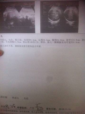 journal_insert_pic_611575885