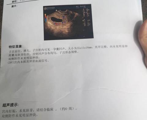 journal_insert_pic_611500136