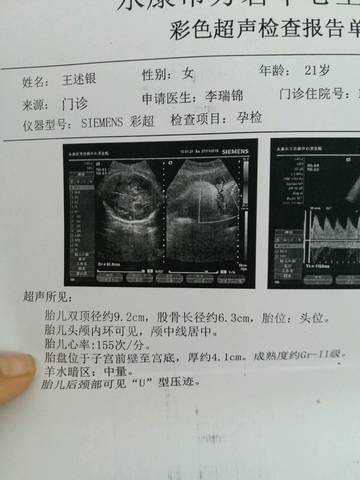 journal_insert_pic_616501637