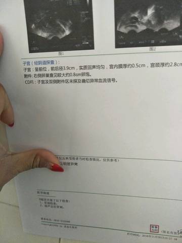 journal_insert_pic_617435983