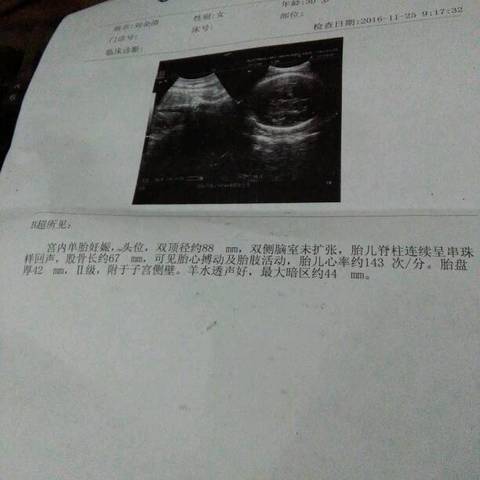 journal_insert_pic_617596168