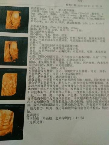 journal_insert_pic_618261752