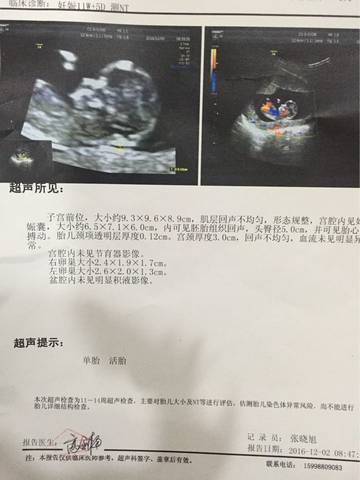 journal_insert_pic_618896163
