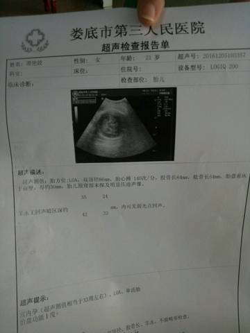 journal_insert_pic_620421448