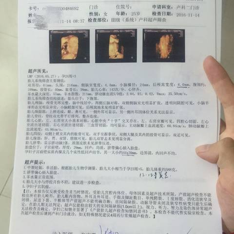 journal_insert_pic_620480760