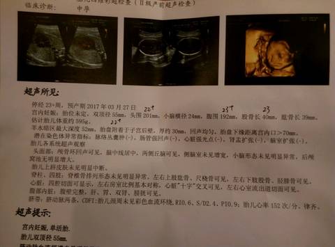 journal_insert_pic_621254800