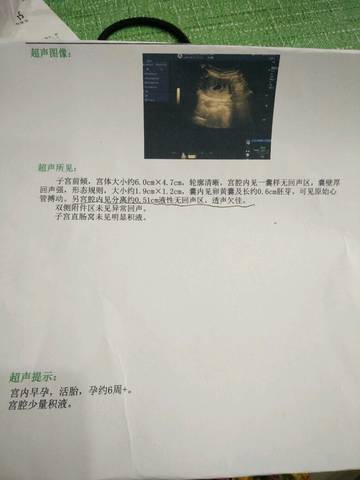 journal_insert_pic_621794372