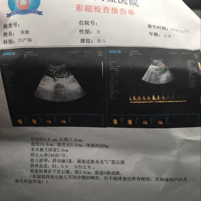 怀孕四个月的彩超单,能看出来是男宝宝还是女宝宝吗?