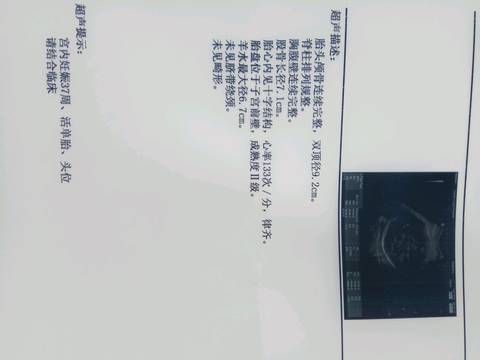 journal_insert_pic_624517007