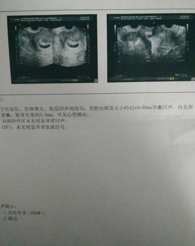 journal_insert_pic_624726171