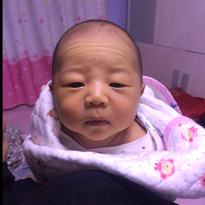 宝宝出生16天 抬头纹可多了 像个小老头 怎麼回事啊