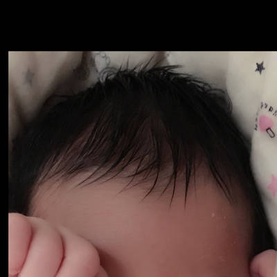 刚出生的婴儿头发图片