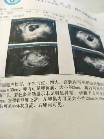 journal_insert_pic_628047216