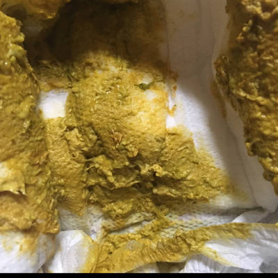 宝宝三个月了,最近拉屎特别稠是怎麼回事呢