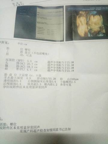 journal_insert_pic_628678493