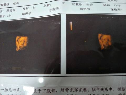journal_insert_pic_629717921
