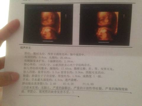 journal_insert_pic_631750794