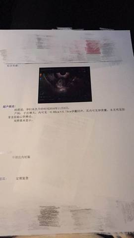 journal_insert_pic_636999307