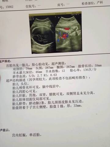 journal_insert_pic_639002239