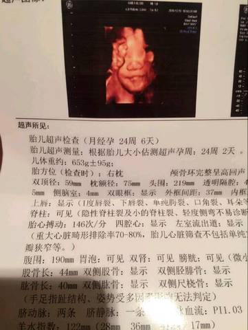 journal_insert_pic_642313785