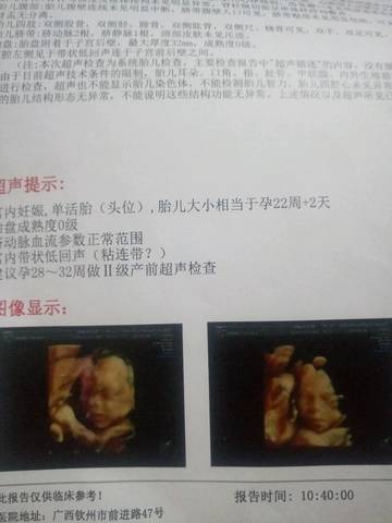 journal_insert_pic_643300973