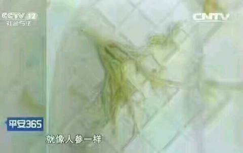 支气管痰栓,气管支气管,空气支气管征(第4页)_大山谷图库