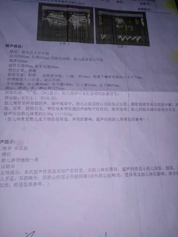 journal_insert_pic_644814174