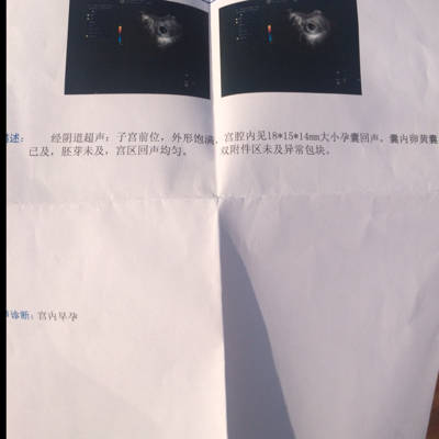 journal_insert_pic_645552293