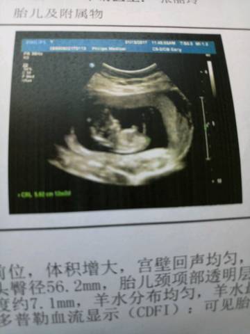 journal_insert_pic_647498578