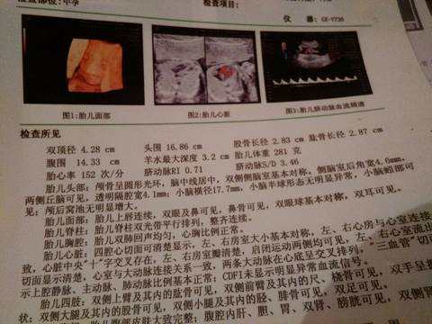 journal_insert_pic_649158914