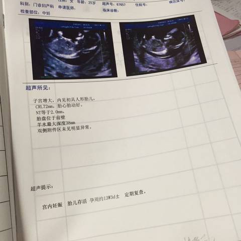 journal_insert_pic_649888484