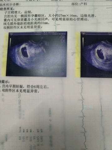 journal_insert_pic_650456816