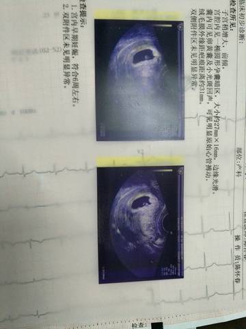 journal_insert_pic_650456736