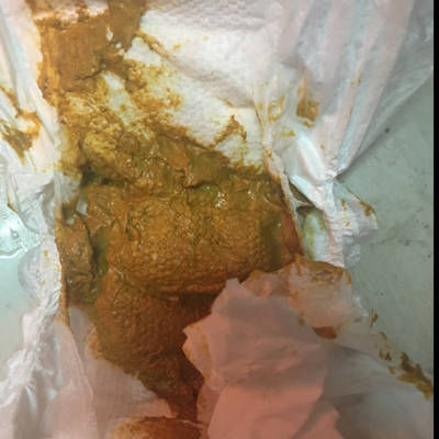 三个月宝宝拉这种粑粑正常吗?有点儿干算不算便秘?