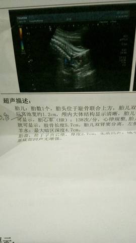 journal_insert_pic_654476059