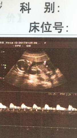 journal_insert_pic_655417821