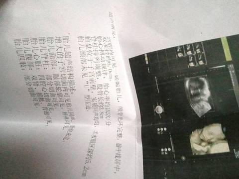 journal_insert_pic_655651962