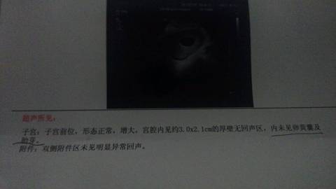 journal_insert_pic_655814631