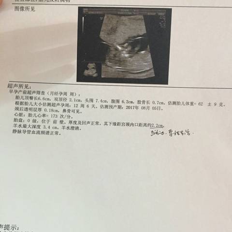 journal_insert_pic_656476086