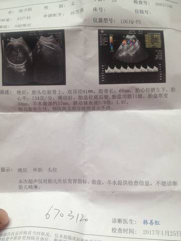journal_insert_pic_658684904