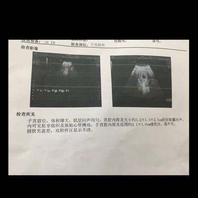 journal_insert_pic_660004718