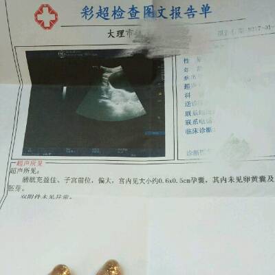 journal_insert_pic_660004886