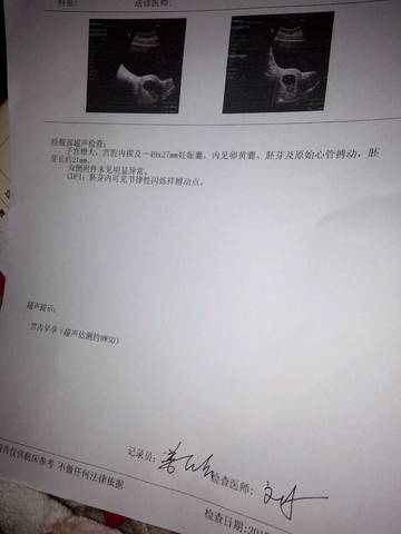 journal_insert_pic_661047917