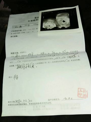 journal_insert_pic_661632322