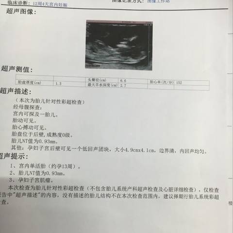 journal_insert_pic_661838036