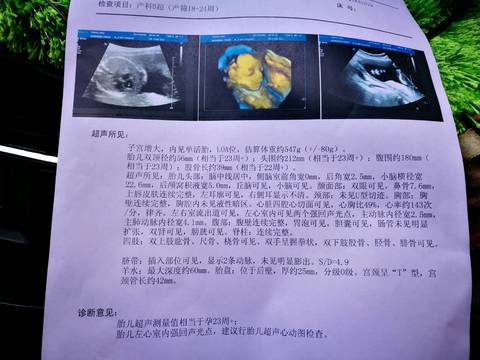 journal_insert_pic_661788438