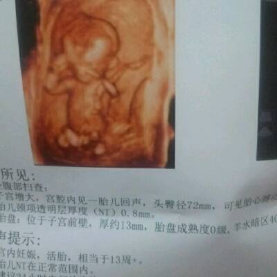 孕13周男宝图 准确率图片