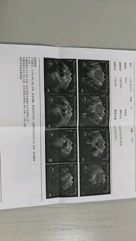 journal_insert_pic_665211830