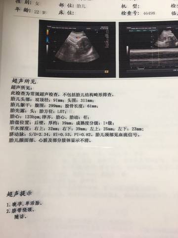 journal_insert_pic_668378062