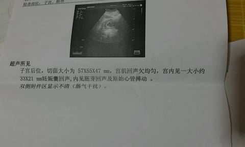 journal_insert_pic_669907496